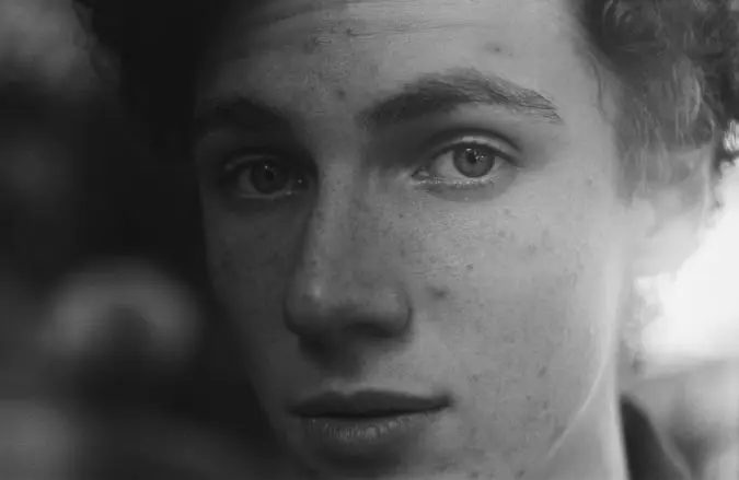 the-face-of-a-young-man-who-has-ADHD